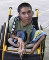 Bild på funktionshindrad man från Vietnam